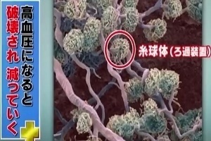 運動 筋肉 衰える 理由
