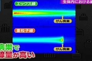 重粒子線治療 がん治療 最前線